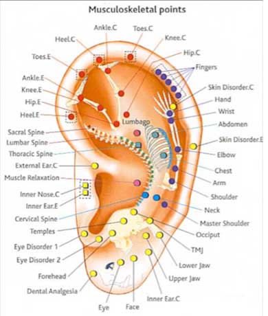 Ear reflexology chart: musculoskeletal points.